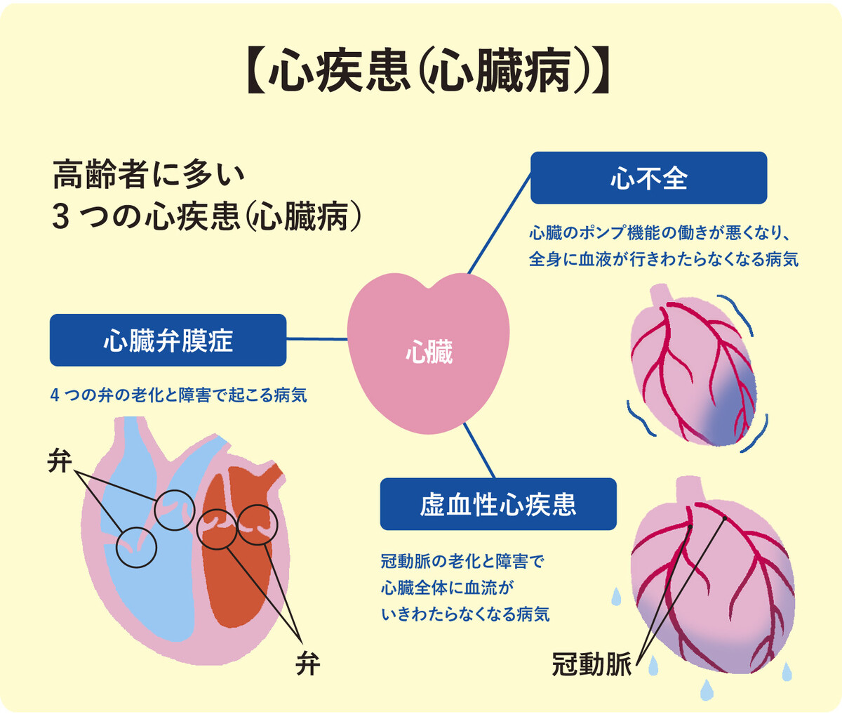   心臓病